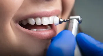 How Much Is a Dental Cleaning Without Insurance