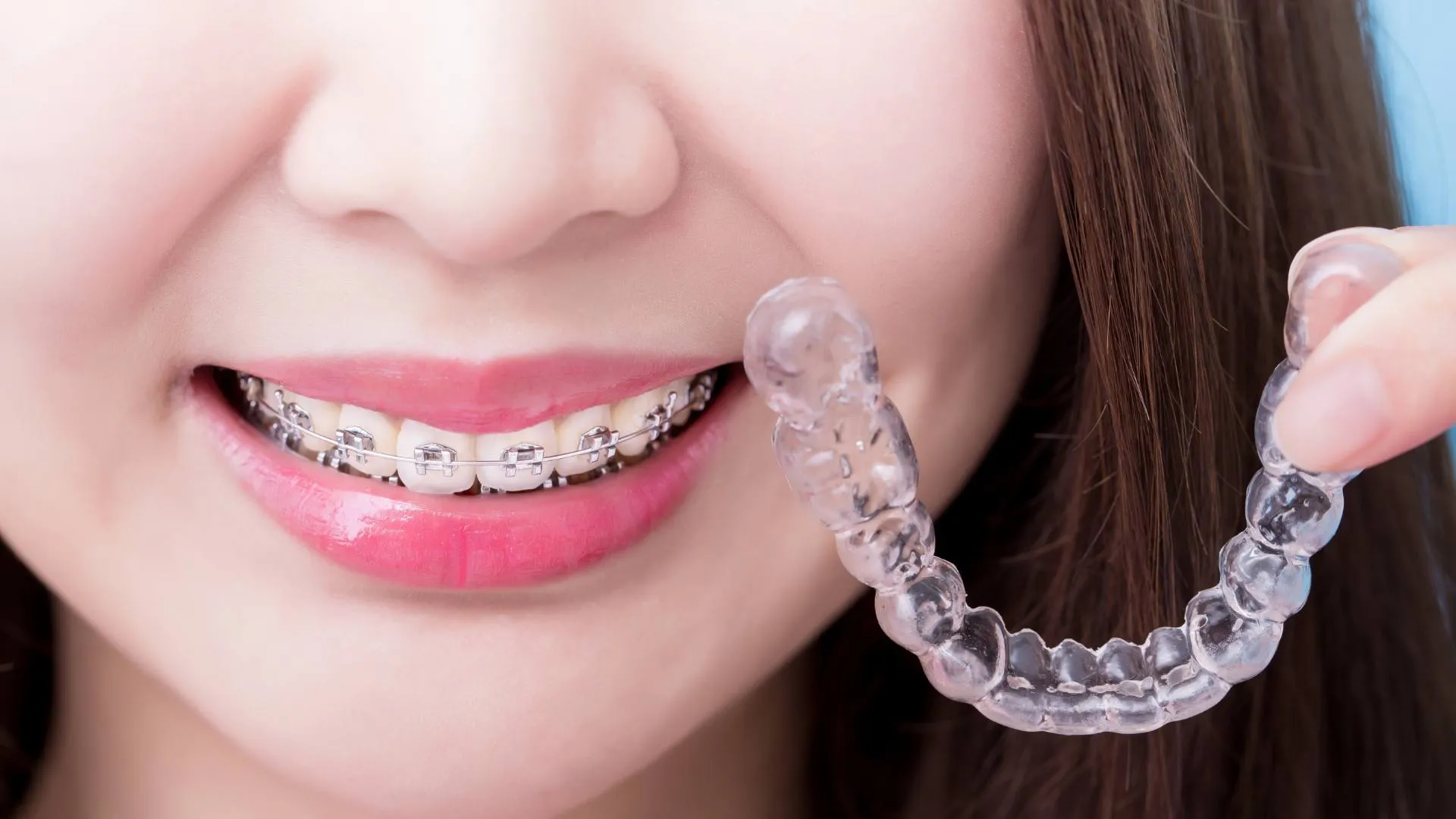 How Much is Invisalign With Insurance
